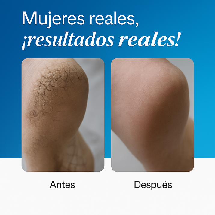 Roll-on Reparador de Urea 20%