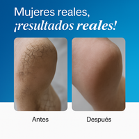 Roll-on Reparador de Urea 20%