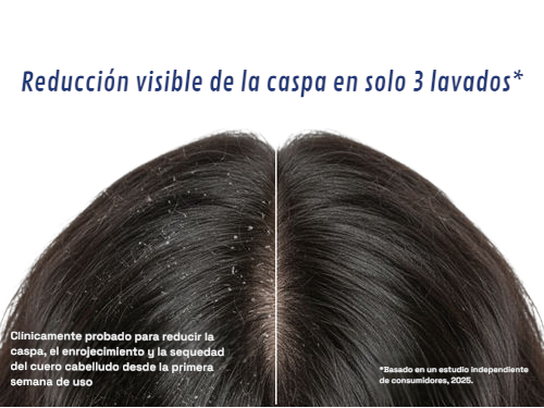 Champú Anticaspa 1% ZPTO (200ml)