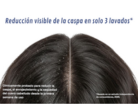 Champú Anticaspa 1% ZPTO (200ml)