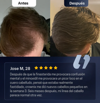 Roll-On de Crecimiento Capilar™