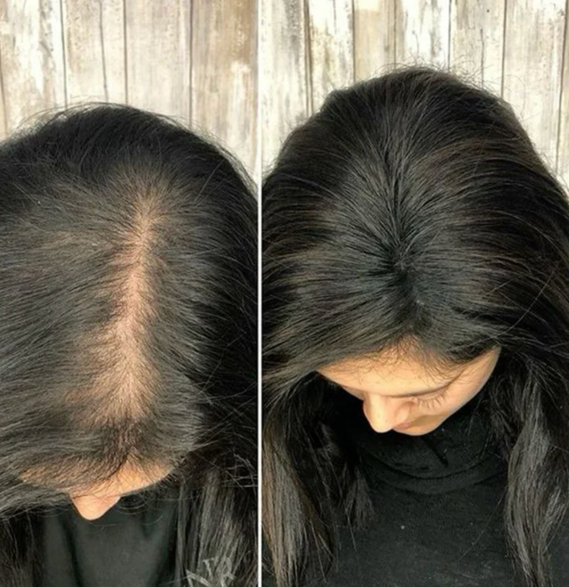 Champú orgánico de romero para el crecimiento del cabello