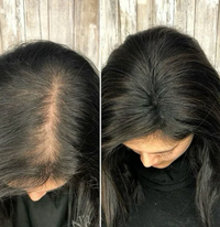 Champú orgánico de romero para el crecimiento del cabello