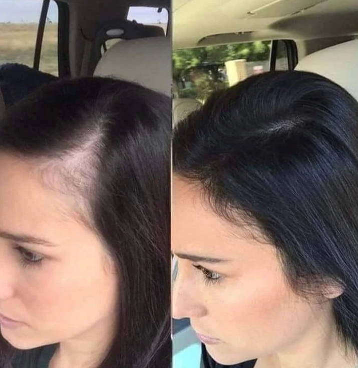 Champú orgánico de romero para el crecimiento del cabello