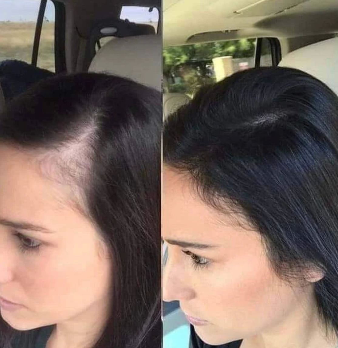 Champú orgánico de romero para el crecimiento del cabello