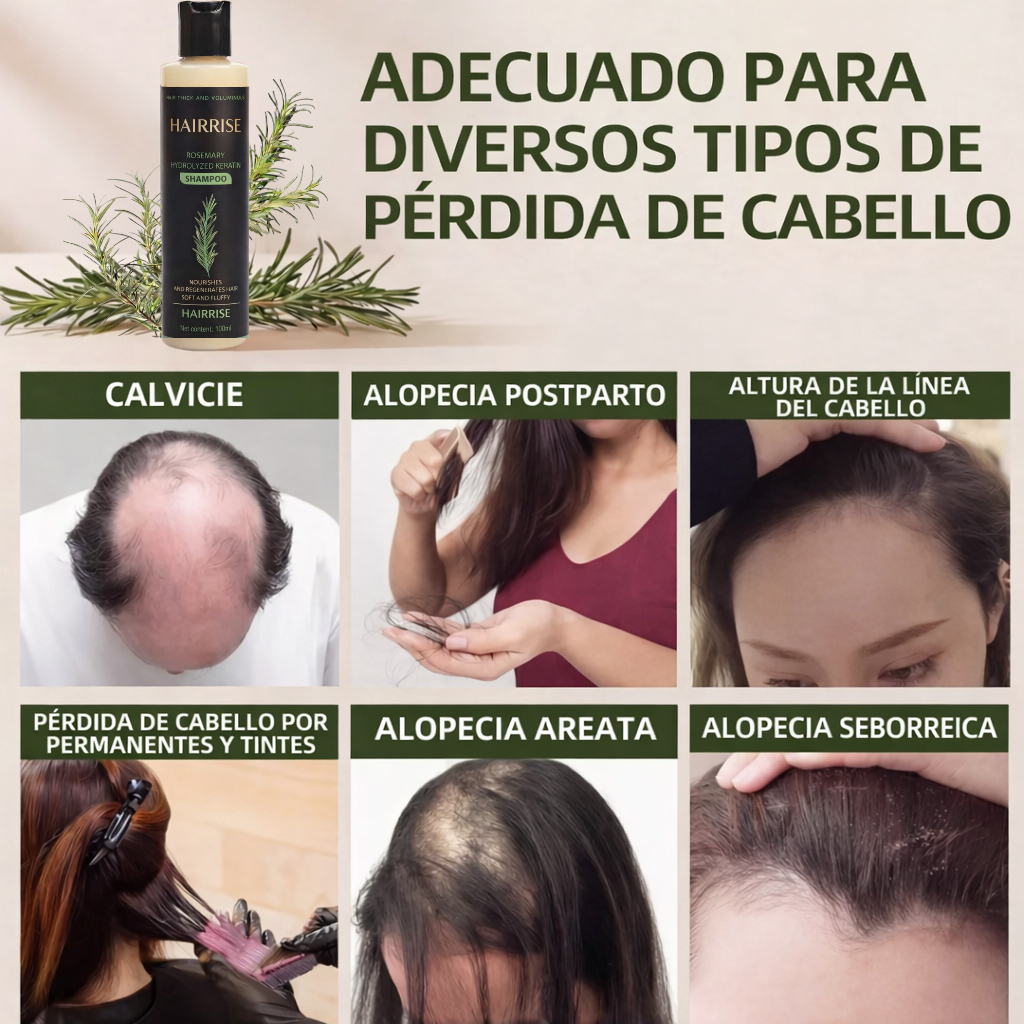 Champú orgánico de romero para el crecimiento del cabello