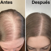 Champú orgánico de romero para el crecimiento del cabello
