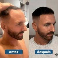 Roll-On de Crecimiento Capilar™