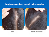 Champú Anticaspa 1% ZPTO (200ml)