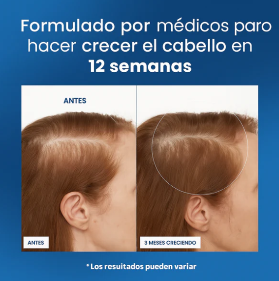 Roll-On de Crecimiento Capilar™