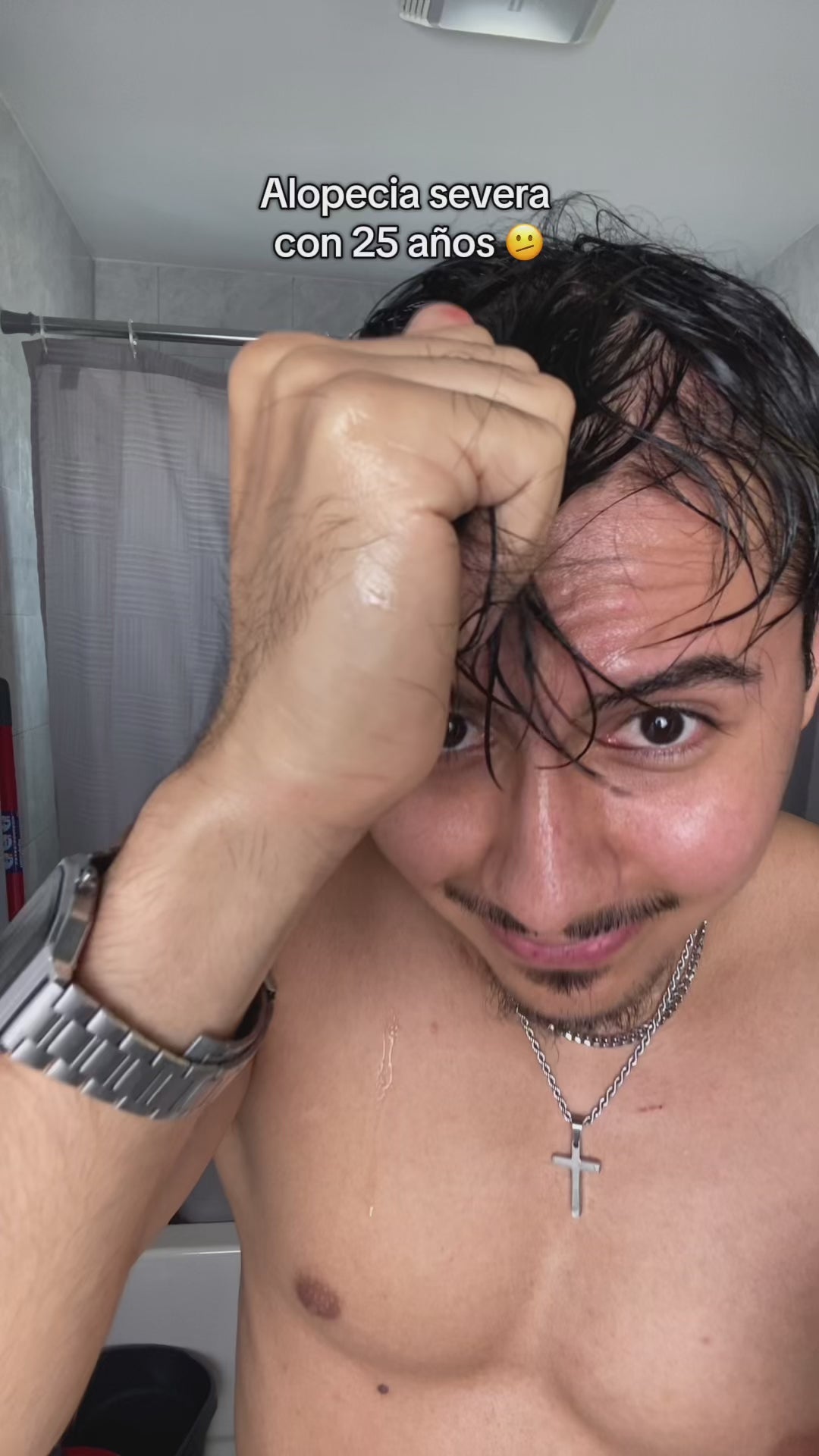 Roll-On de Crecimiento Capilar™ video